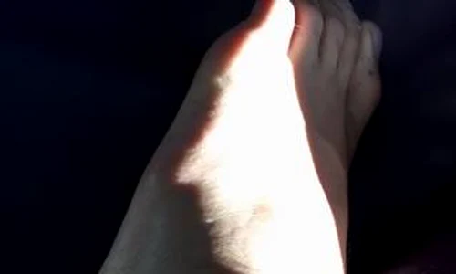 Justin Bieber le a arătat fanilor piciorul accidentat jpeg