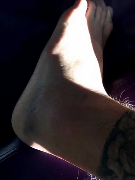 Justin Bieber le-a arătat fanilor piciorul accidentat