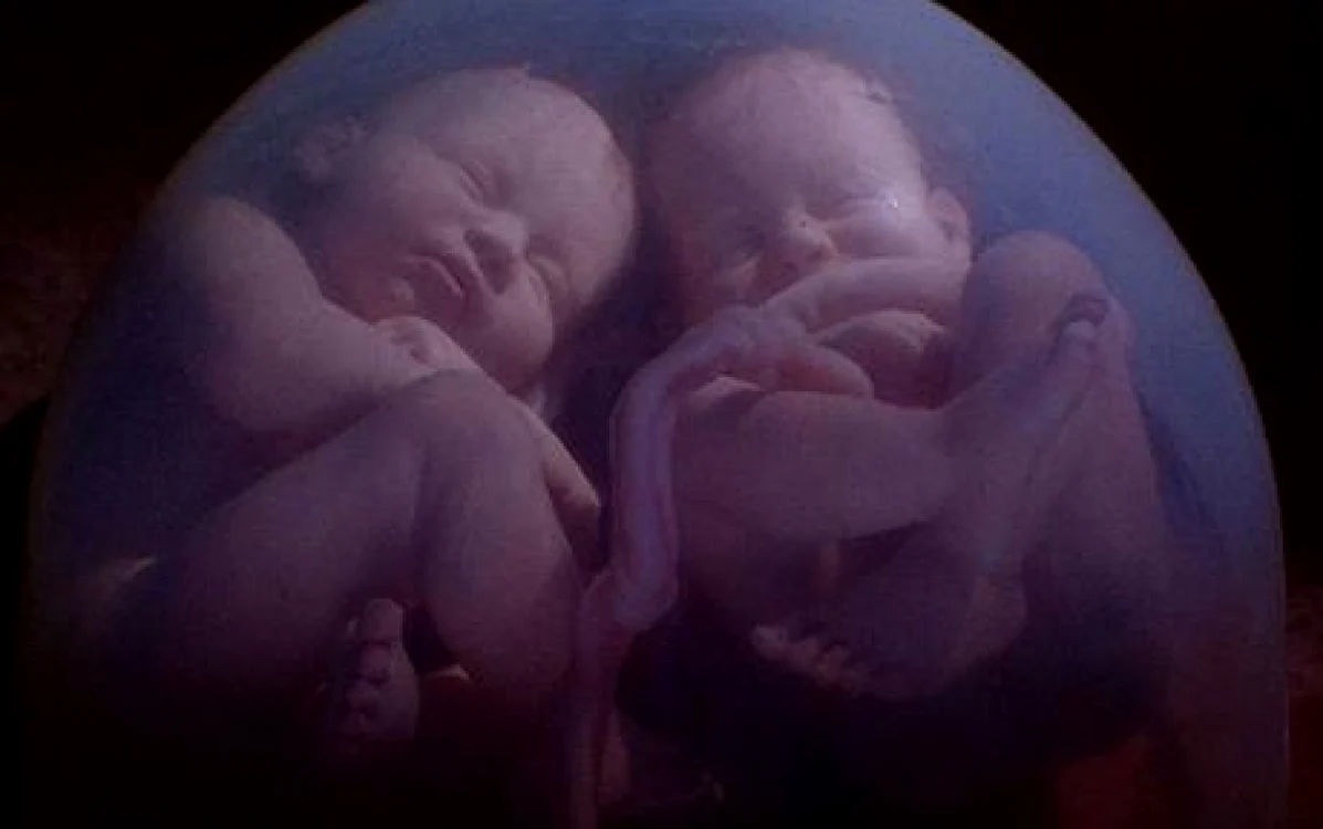 Gemenii identici împart aceeaşi placentă FOTO National Geographic Channel