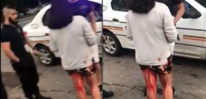Trecătorii au vorbit cu fata plină de sânge, în timp ce poliţiştii au stat în maşină Foto: captură video