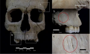 Urmele descoperite de cercetători pe fragmentele de craniu (© Marta Riba-Vidal / Trabajos de Prehistoria (2025). DOI: 10.3989/tp.2025.1049)