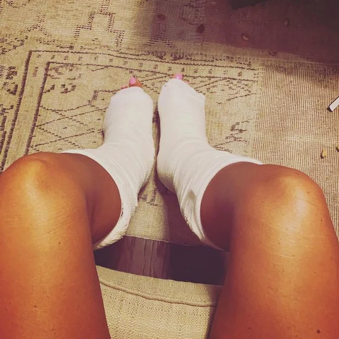 Așa arată acum picioarele fostului model