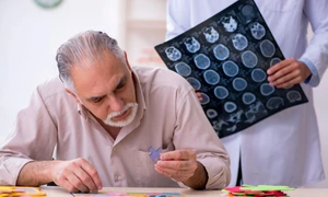 pacient Alzheimer jpg