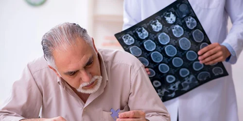 pacient Alzheimer jpg