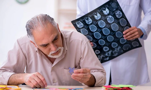 pacient Alzheimer jpg