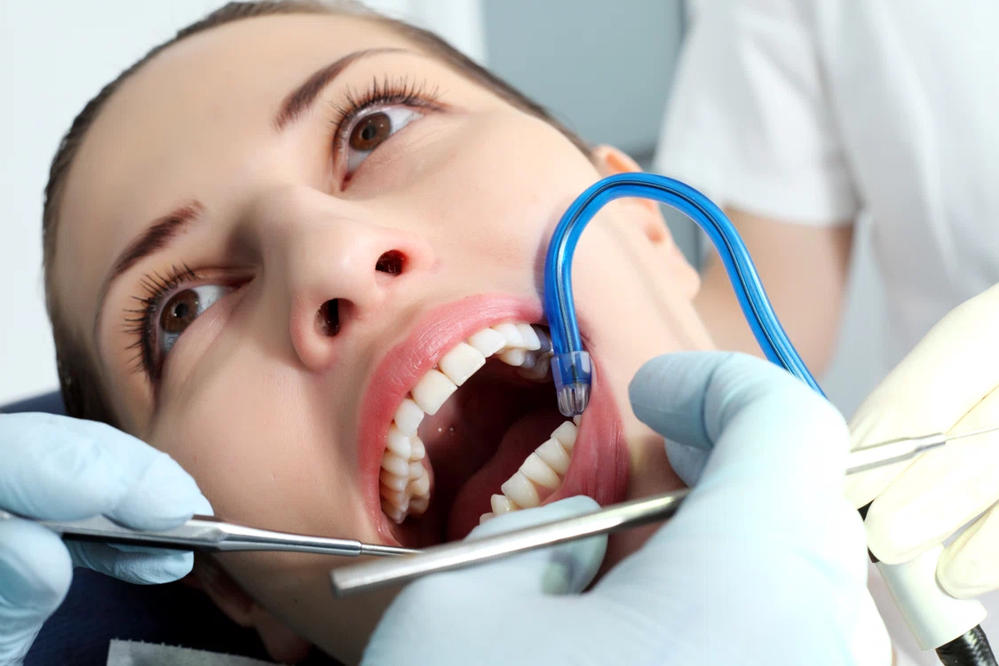 Stomatologul îţi poate spune dacă eşti un bun candidat pentru faţete dentare