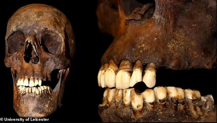 Fumatul poate lăsa urme în oasele tale timp de mai multe secole Foto: University of Leicester
