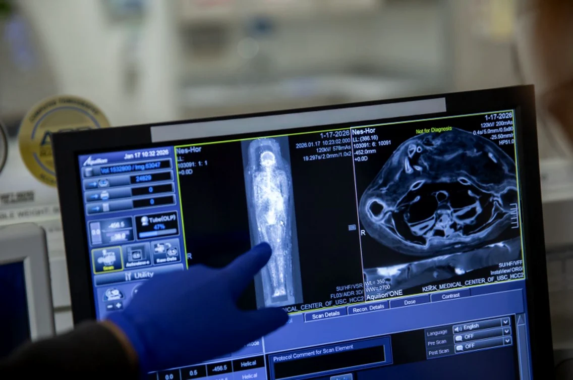 Scanările CT dezvăluie secretele mumiilor (© Ricardo Carrasco III / Keck Medicine of USC)