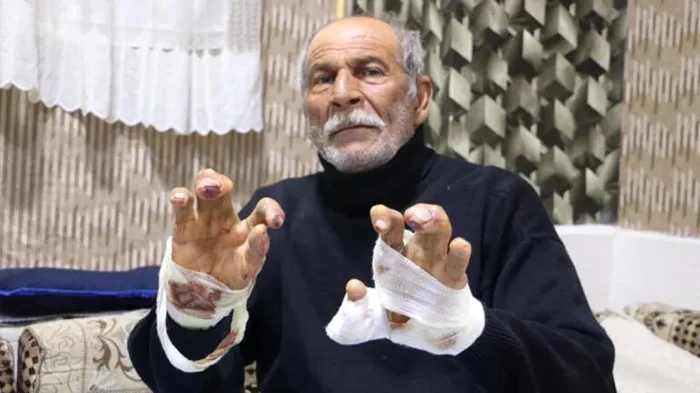 Reșat Ayva a scăpat miraculos cu viață FOTO: milliyet.com.tr
