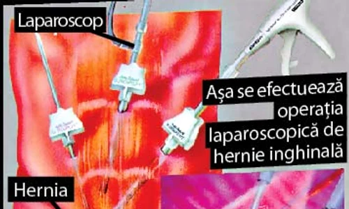 Dan Bittman (51 de ani)  a ajuns de patru ori în spital  în ultimele şapte luni ( FOTO: ARHIVA PERSONALĂ) jpeg