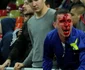 Incidente Romania Ungaria FOTO Mediafax