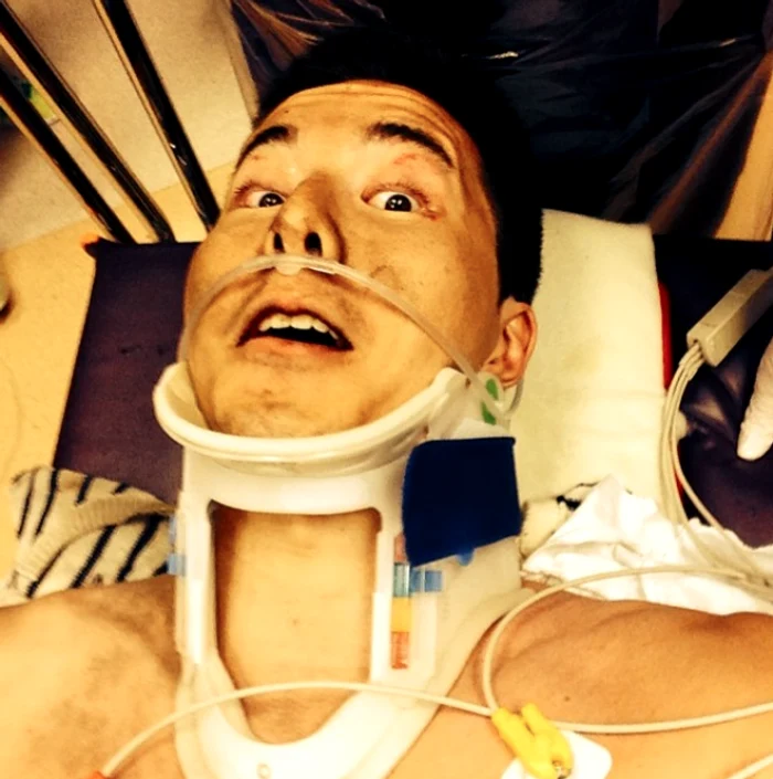 
    Sasha Eliasson, bărbatul care a sfidat moartea, şi-a "tras" selfie pe patul de spital foto: facebook  