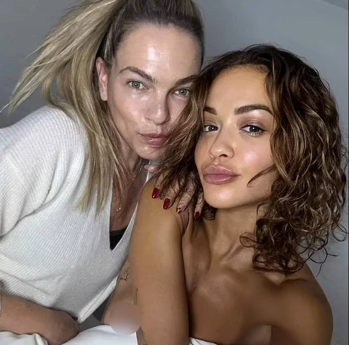 Rita Ora cu prosopul alunecat. FOTO: Daily Mail