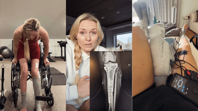„Am fost numărul 1 în lume, acum sunt într-un scaun cu rotile!”. Coșmar pentru Lindsey Vonn, după ce piciorul i-a fost „zdrobit” la JO. Campioana nu-și revine