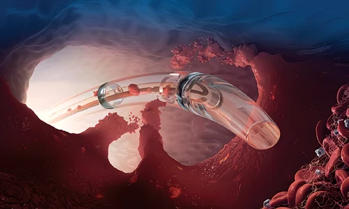 02 12 ClickSanatate jpg