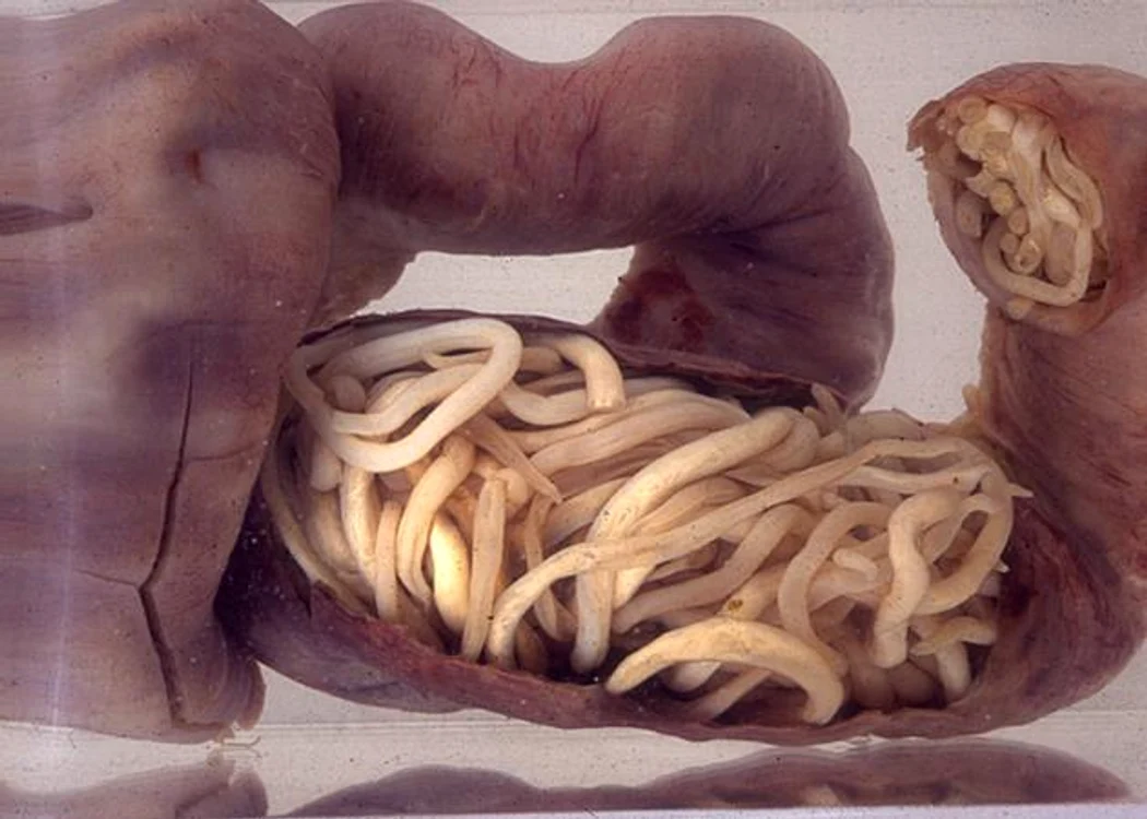 1 ai aceste simptome intestinele tale ar putea fi pline de paraziti uite ce sa faci ca sa scapi de ei kzjb jpg jpeg