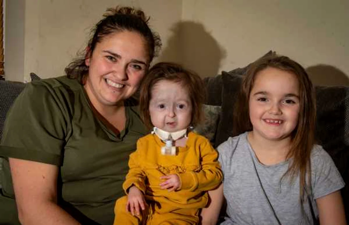 Isla Kilpatrick Screatonfetita care seufera de boala Benjamin Button FOTO Profimedia