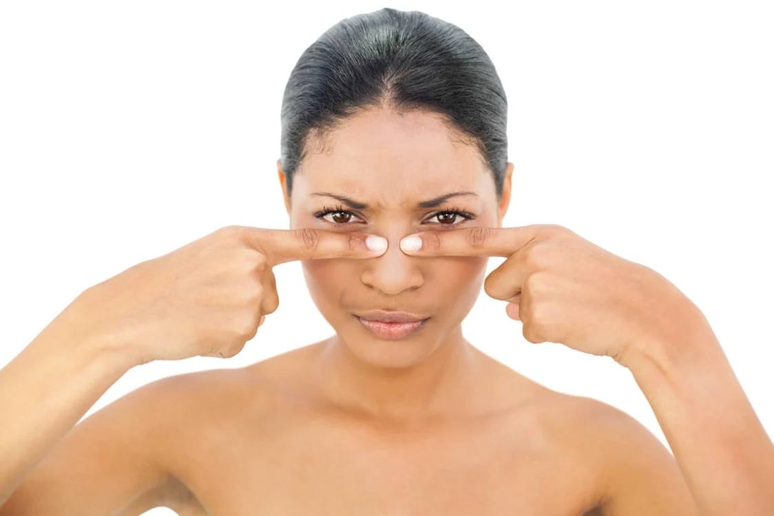 Cea mai mare greşeală este să îţi storci cu degetele punctele negre: pielea va fi lezată şi mult mai sensibilă la atacul bacteriilor FOTO Shutterstock