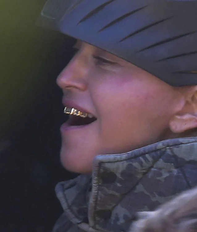 Madonna are aparat dentar din aur