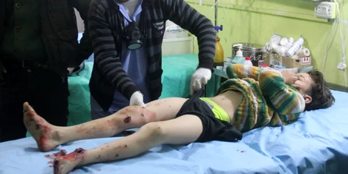 Copil care primeste ingrijiri dupa un atac chimic in Siria FOTO AFP