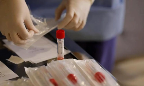 1 teste coronavirus jpg jpeg