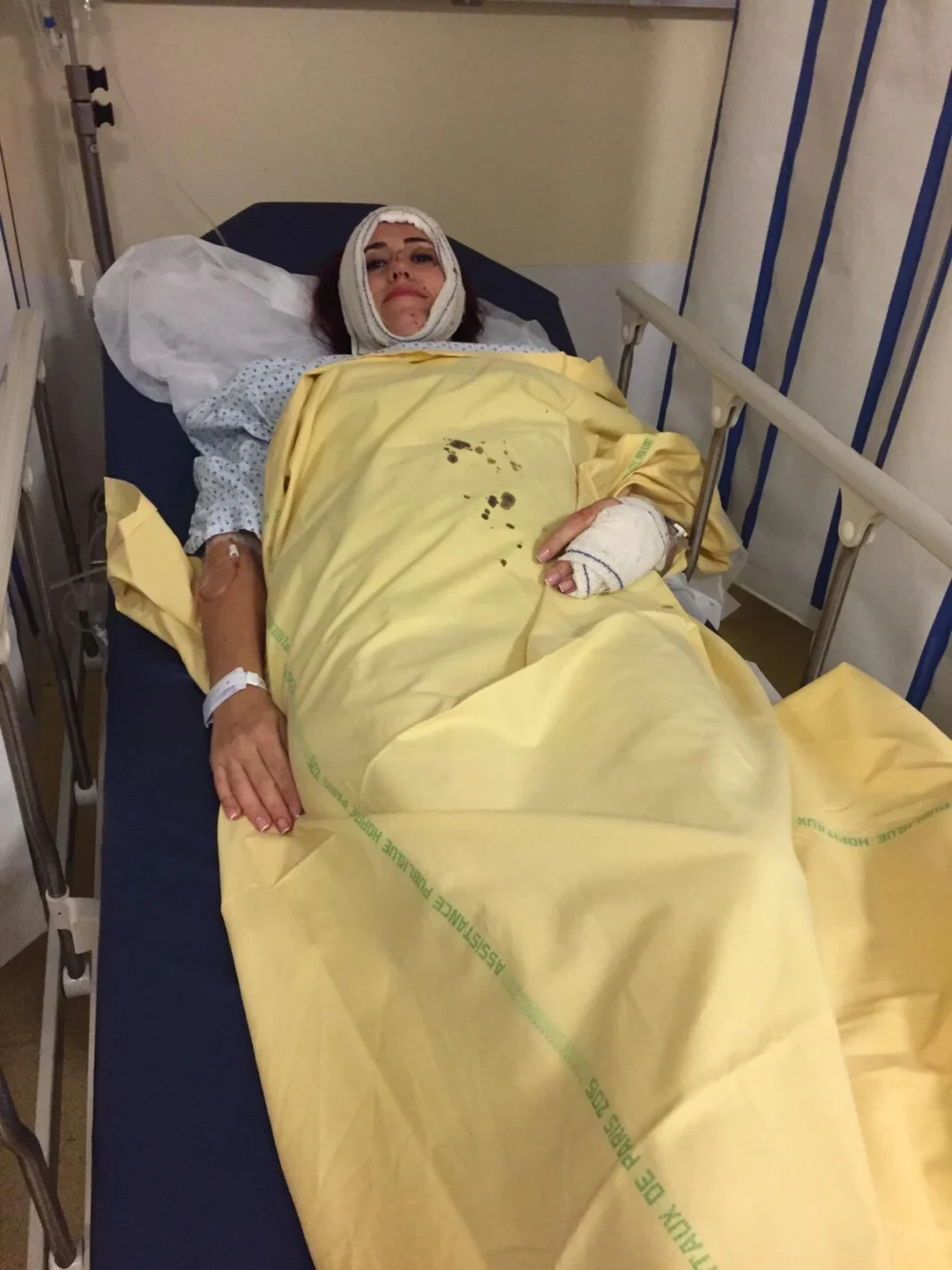 „Glonțul s-a oprit la câțiva milimetri de creier”. Povestea cutremurătoare a româncei care a supraviețuit în mod miraculos în atentatele din Paris, din 2015