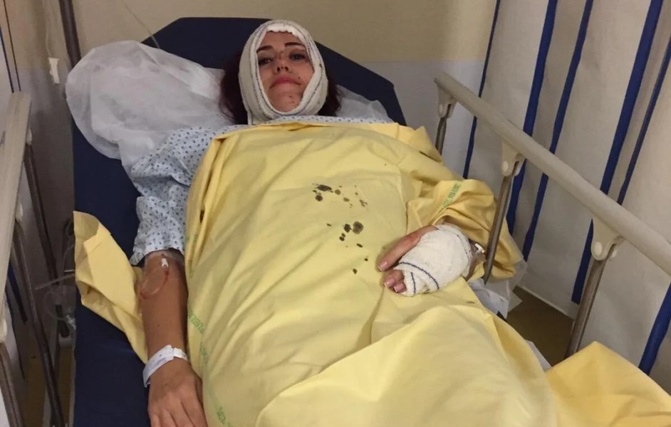 „Glonțul s-a oprit la câțiva milimetri de creier”. Povestea cutremurătoare a româncei care a supraviețuit în mod miraculos în atentatele din Paris, din 2015