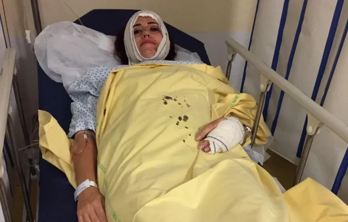 Cezara Popescu a fost grav rănită FOTO: Pagina de media