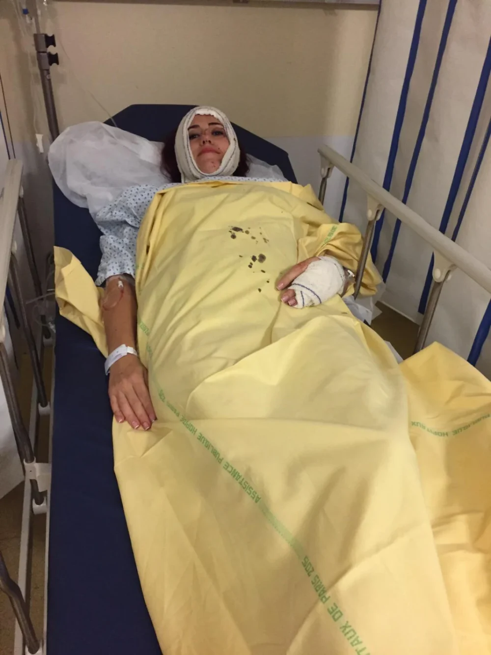 „Glonțul s-a oprit la câțiva milimetri de creier”. Povestea cutremurătoare a româncei care a supraviețuit în mod miraculos în atentatele din Paris, din 2015