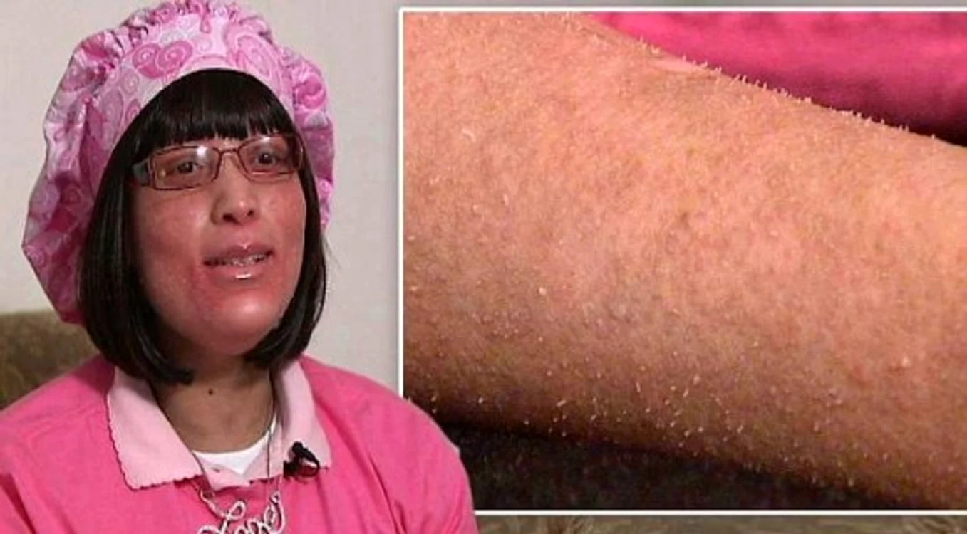 
    Aşa arată Shanya acum, după doi ani de tratamenteCaptură video  
