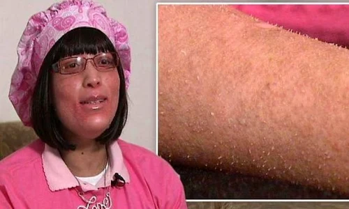 shanyna isom condition 550x304 jpeg