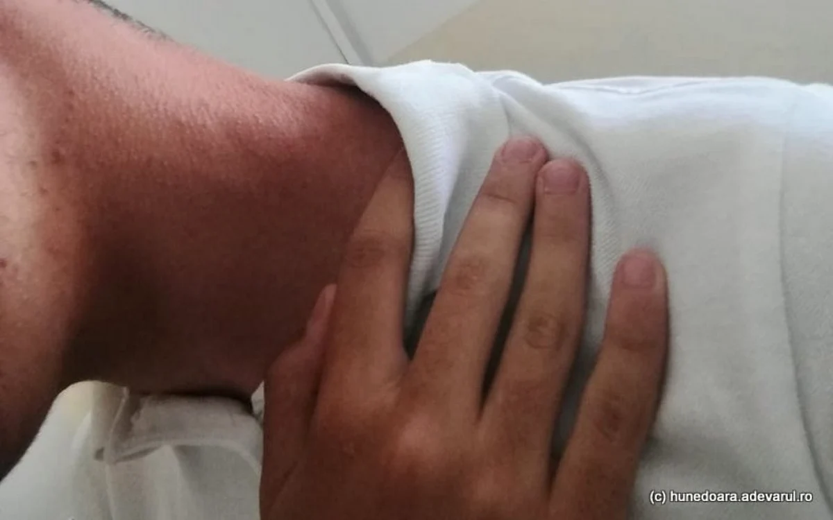 Elevul agresat. Sursa: ADEVĂRUL