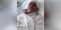 barbat cu o tumora din judetul neamt, salvat de medicii ieseni foto facebook png