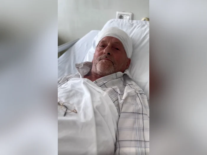 VIDEO Bărbat de 67 de ani, salvat de medicii din Iași. Acesta s-a prezentat cu o tumoră cerebrală uriașă, de aproximativ 10 cm