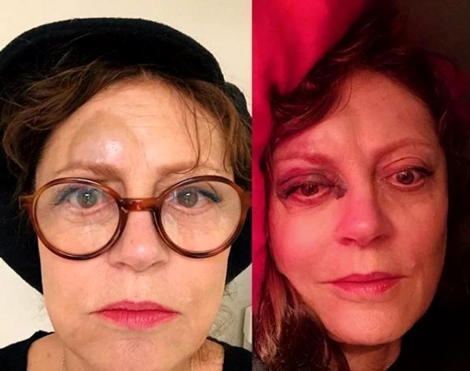 
    Susan Sarandon s-a accidentat în urma unei căzături Foto: Instagram   