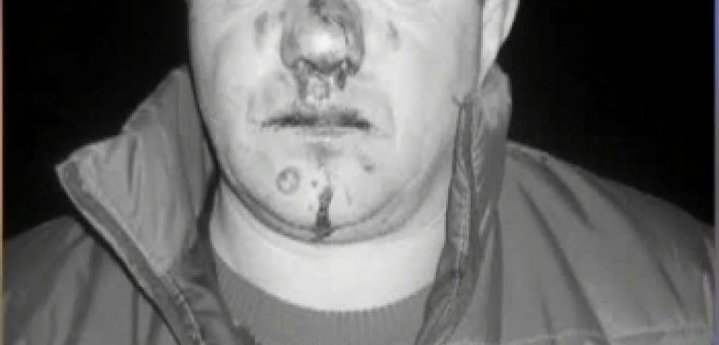 Bărbatul susţine că a fost bătut crunt de viceprimarul oraşului FOTO: rtv.net Bărbatul susţine că a fost bătut crunt de viceprimarul oraşului FOTO: rtv.net