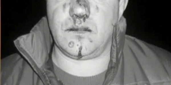 Bărbatul susţine că a fost bătut crunt de viceprimarul oraşului FOTO