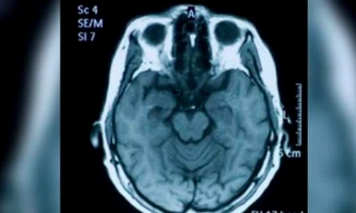 Oamenii uituci sunt mai inteligenţi decât cei care îşi amintesc orice detaliu jpeg