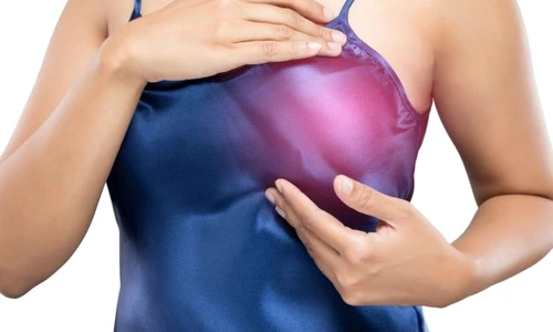 Primele semne ale cancerului mamar jpeg