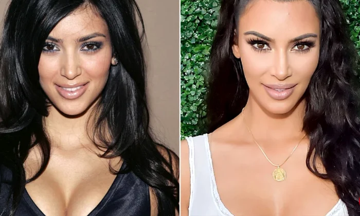 1 kim nas png png