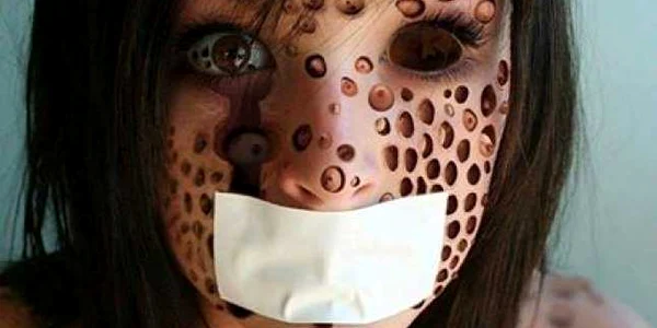 tripofobia