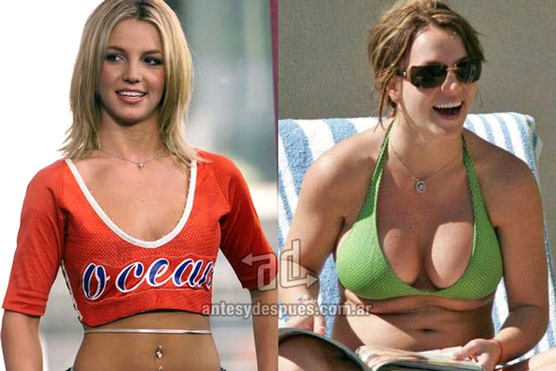 vedete tunate, dive silicoane, britney spears