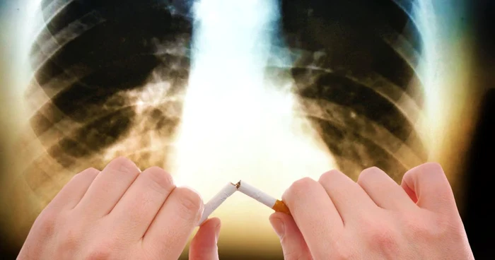 Renunţarea la fumat aduce beneficii imediate. FOTO Shutterstock