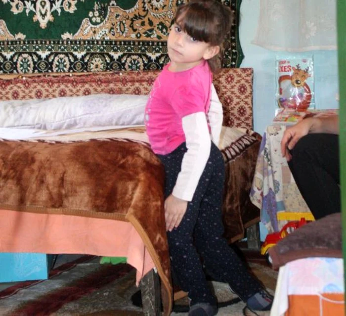 Denisa s-a născut cu picioarele întoarse la spate şi a suferit 15 operaţii