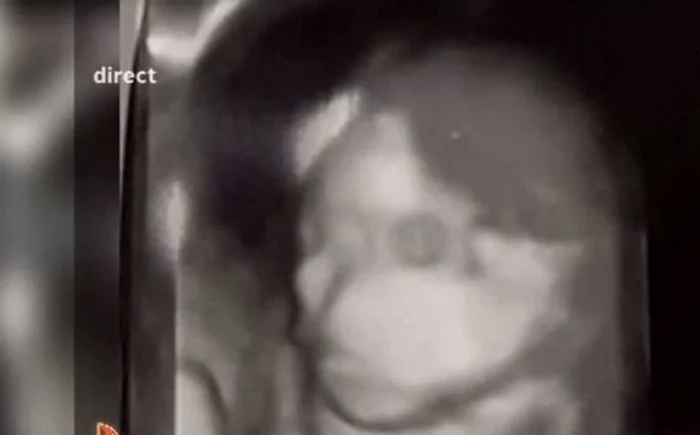 Pepe va deveni tătic pentru a doua oarăFoto Antena 1