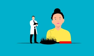 Cum iti dai seama ca ai nevoie de tratamente cu proteine pentru par  Sursa foto Pixabay hair loss 7273281 1280 png