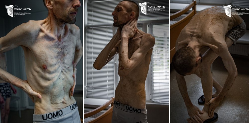 Imagini șocante din camerele de tortură ale Rusiei. Starea unui prizonier ucrainean după 2 ani de detenție aduce aminte de lagărele naziste
