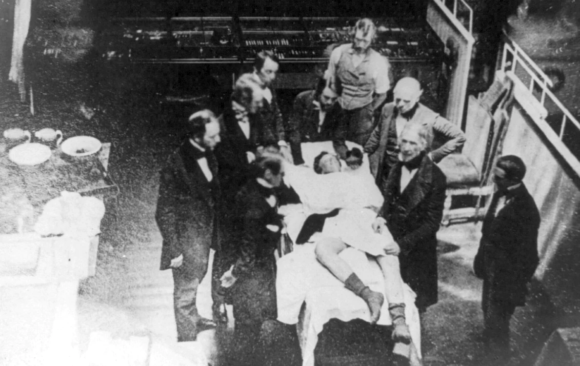 Imagine de epocă de la primele anestezii. FOTO wikipedia
