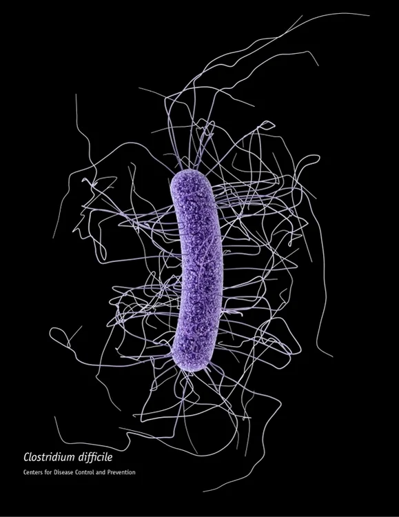 
    Clostridium difficile este o bacterie foarte rezistentă la orice fel de tratament. Este, de multe ori, o bacterie intraspitalicească  