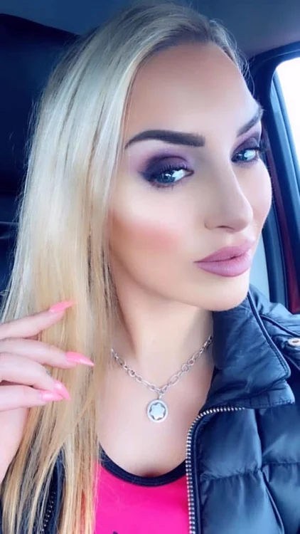 Tracy obișnuia să-și facă lunar injecții cu acid hialuronic și Botox (Foto: Profimedia)
